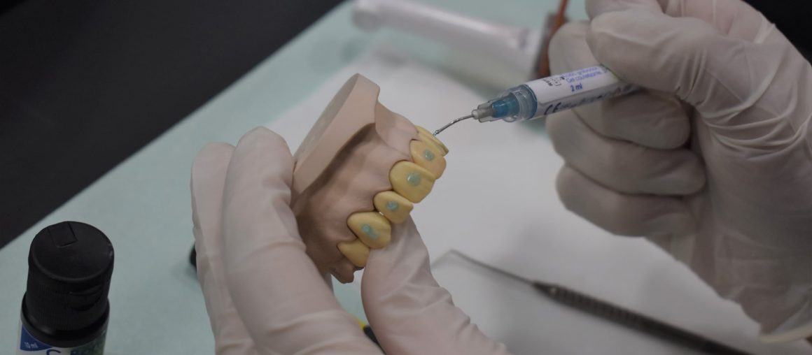 Работилница: Изработка на жичано-композитна имобилизација при луксациони повреди на забите